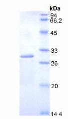 Mouse DLAT / PDC-E2 Protein (Recombinant His, N-Terminal)