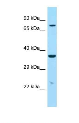 IDUA / MPS1 Antibody (aa509-558)