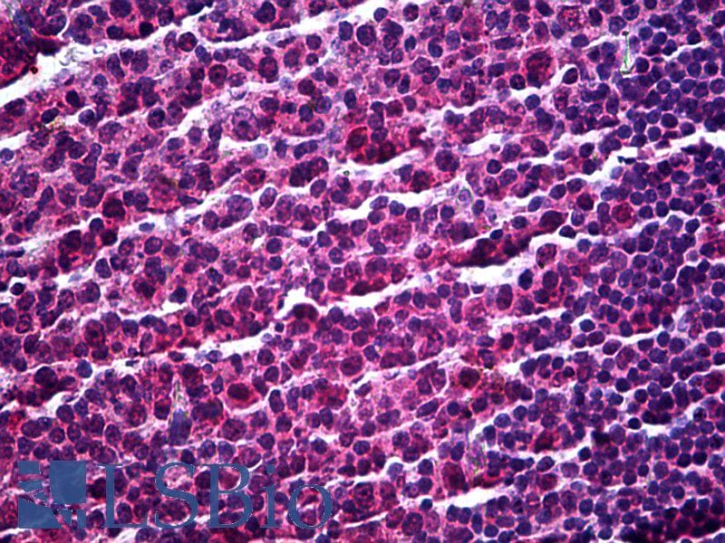 IHC-plus™ Monoclonal Mouse anti-Human SP140 Antibody (clone 3F9, IHC)