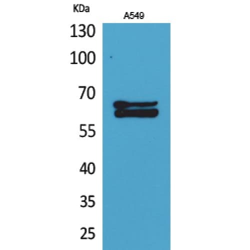 NUMB Antibody (Internal)