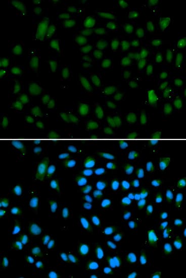 NSD3 / WHSC1L1 Antibody