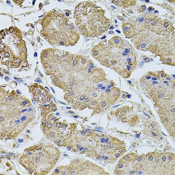 Polyclonal Rabbit anti-Human PTCD3 Antibody (IHC, WB)