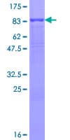Human TEM7 Protein (Recombinant GST)