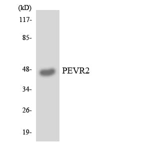 SLC52A1 / GPR172B / PAR2 Antibody (aa225-274)