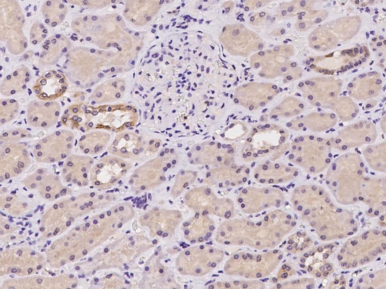 FAM161B Antibody