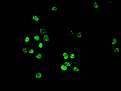 Polyclonal Rabbit anti-Human HIST1H3A Antibody (IHC, IF, WB)