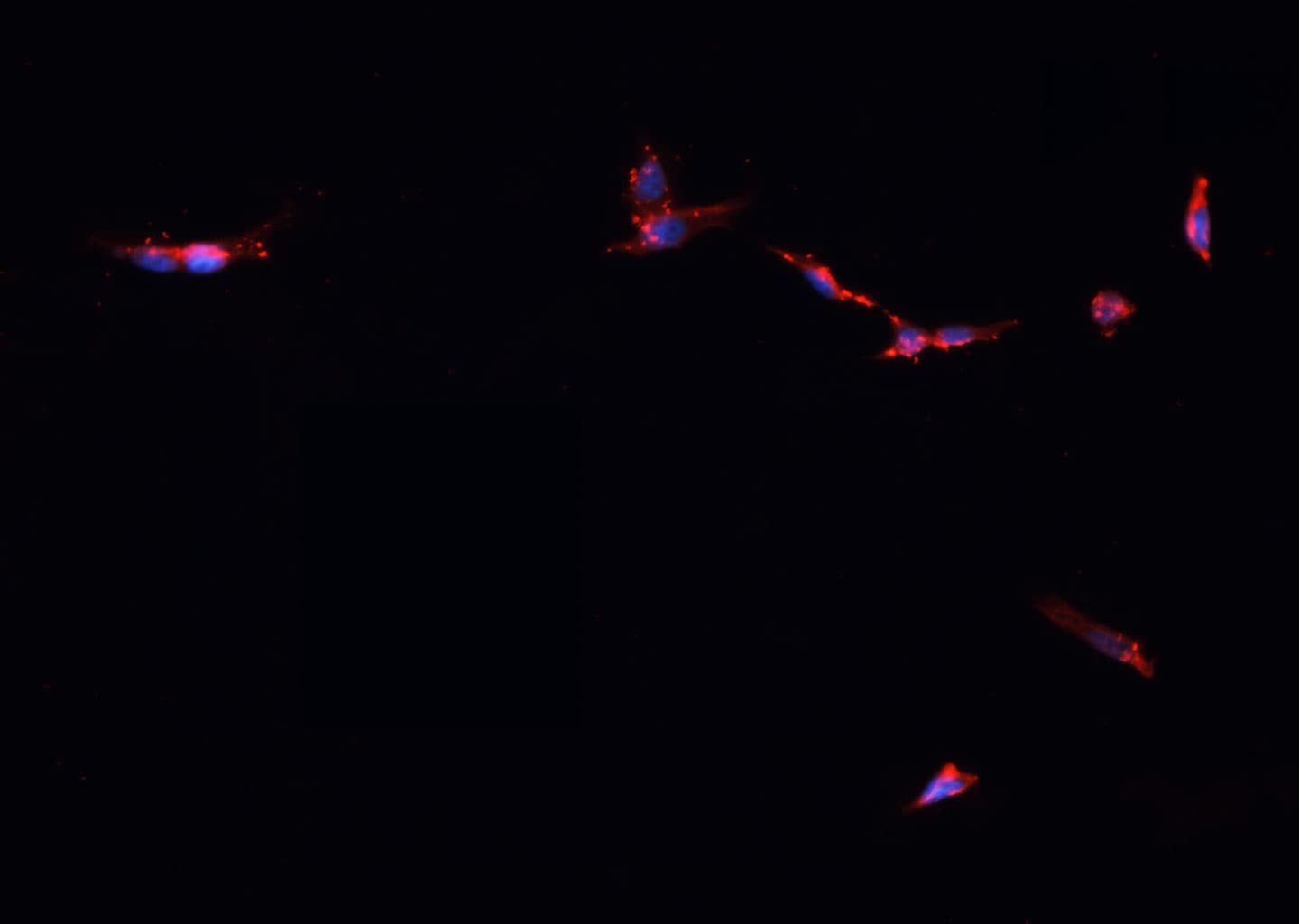 IDH2 Antibody