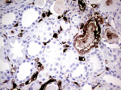S100A9 / MRP14 Antibody (clone UMAB173)