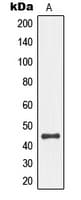 MAP2K4 / MKK4 Antibody (phospho-Ser80)