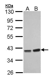 PPP1CC / PP1 Gamma Antibody (aa2-227)