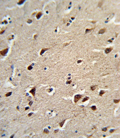 OAT Antibody (aa27-55)