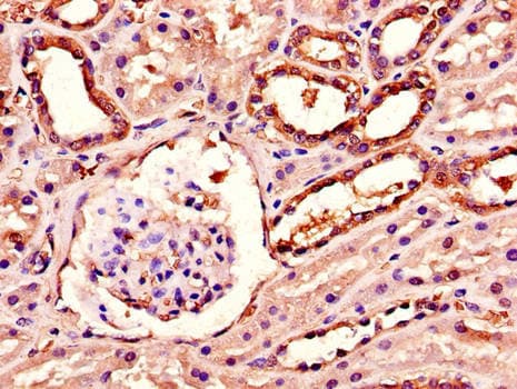 AGK Antibody