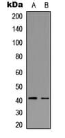 CCR5 Antibody (phospho-Ser336)