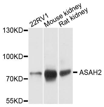ASAH2 Antibody