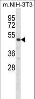 RPS6KB2 / S6K2 Antibody (aa318-346)