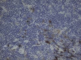 Monoclonal Mouse anti-Human F13A1 / Factor XIIIa Antibody (clone OTI3G12, IHC, WB)