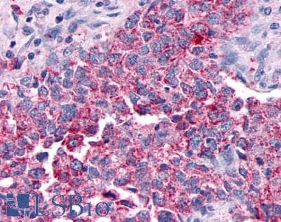 PathPlus™ Polyclonal Rabbit anti-Human GPER1 / GPR30 Antibody (Extracellular Domain, IHC, IF)