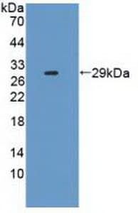 IL2RA / CD25 Antibody (aa22-213)