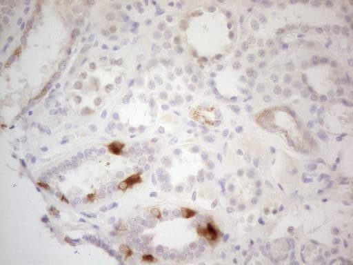 PDIA6 / ERP5 Antibody (clone OTI2H3)