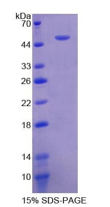 Human FGB / Fibrinogen Beta Chain Protein (Recombinant His, N-Terminal)