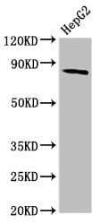 Polyclonal Rabbit anti-Human MTSS1 / MIM Antibody (IHC, WB)