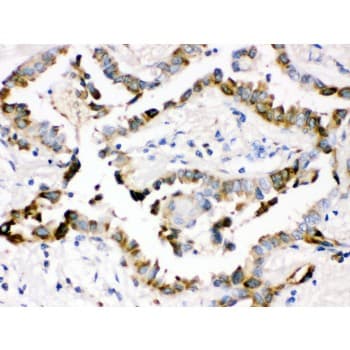 SFTPD / Surfactant Protein D Antibody (aa292-321)