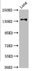 Polyclonal Rabbit anti-Human MAN2B2 Antibody (IHC)