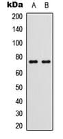 TP63 / p63 Antibody (phospho-Ser455)