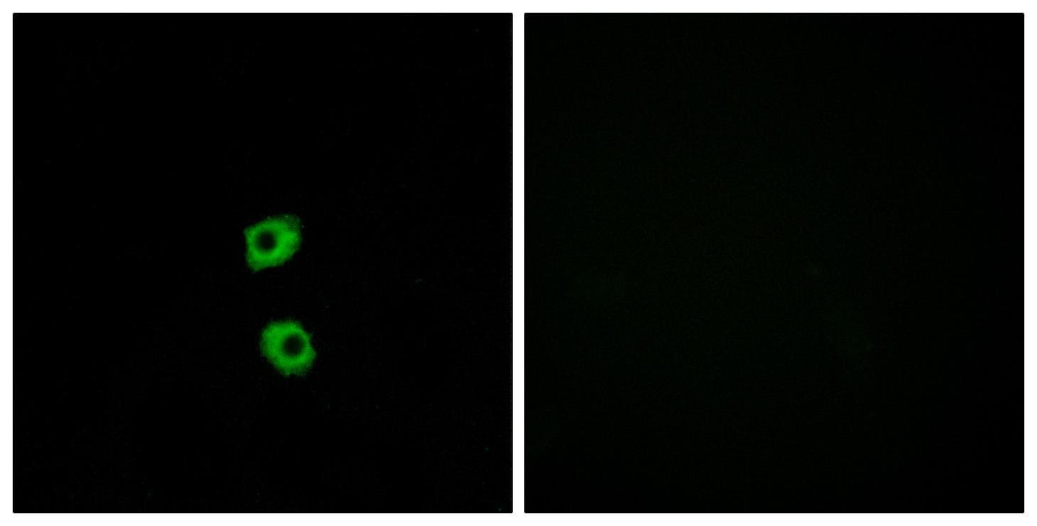 FZD7 / Frizzled 7 Antibody
