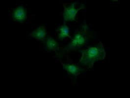 MAGEA4 Antibody (clone OTI2C1)