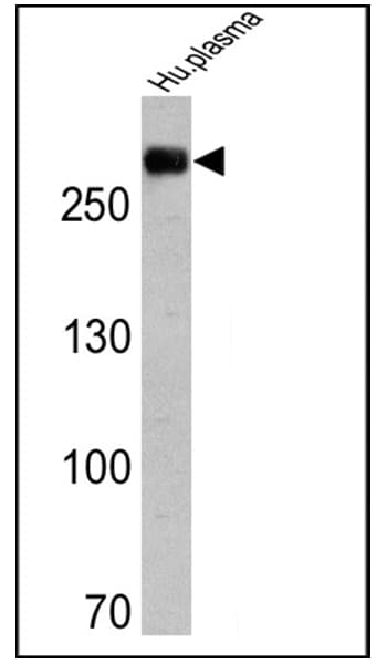 FN1 / Fibronectin Antibody (clone 3F12)