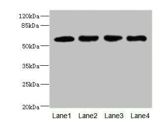 Polyclonal Rabbit anti-Human IL21 Receptor Antibody (IHC, WB)