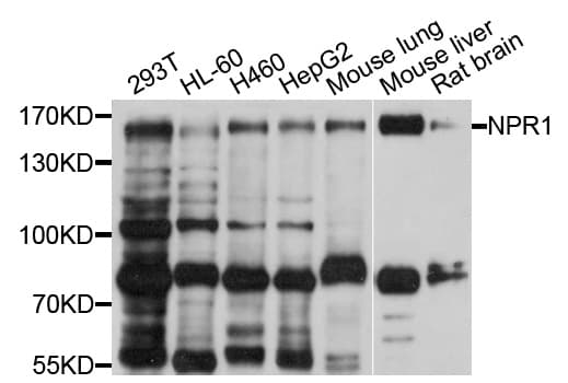 IHC-plus™ NPRA / NPR1 Antibody