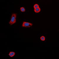 MC5R / MC5 Receptor Antibody (C-Terminus)