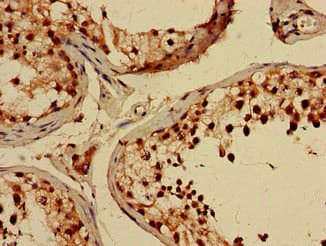 Polyclonal Rabbit anti-Human CREB3L4 / AIBZIP Antibody (IHC)