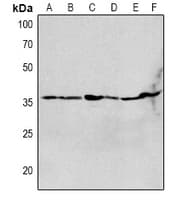 CHRNA1 Antibody