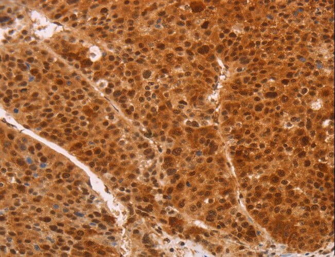 Polyclonal Rabbit anti-Human HEXIM1 Antibody (IHC)