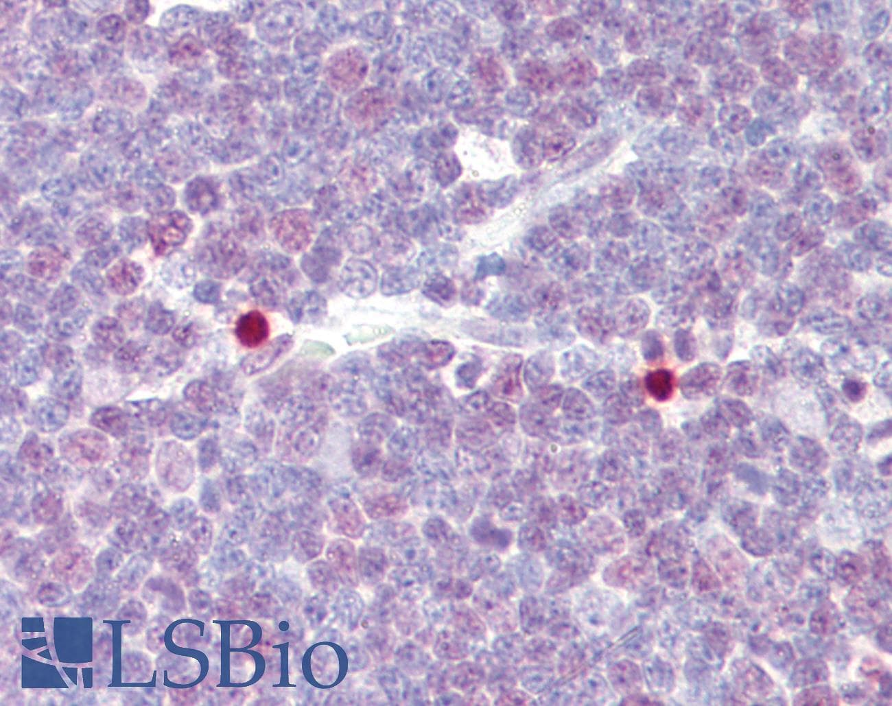 IHC-plus™ CREB1 / CREB Antibody (aa91-140)