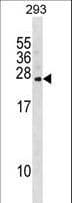 FKBP14 Antibody (aa143-172)