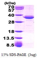 Human GPD1 Protein (Recombinant)
