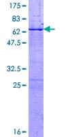Human MPG Protein (Recombinant GST)