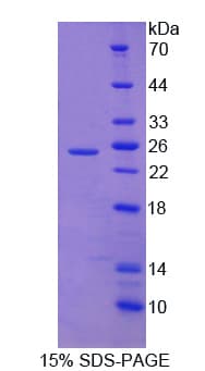 Human Neurotrypsin Protein (Recombinant His-T7, N-terminus)