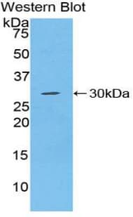 CD66a / CEACAM1 Antibody (aa149-403)