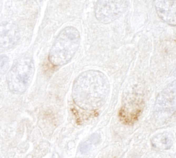 Polyclonal Rabbit anti-Human GBF1 Antibody (aa1809-1859, IHC)