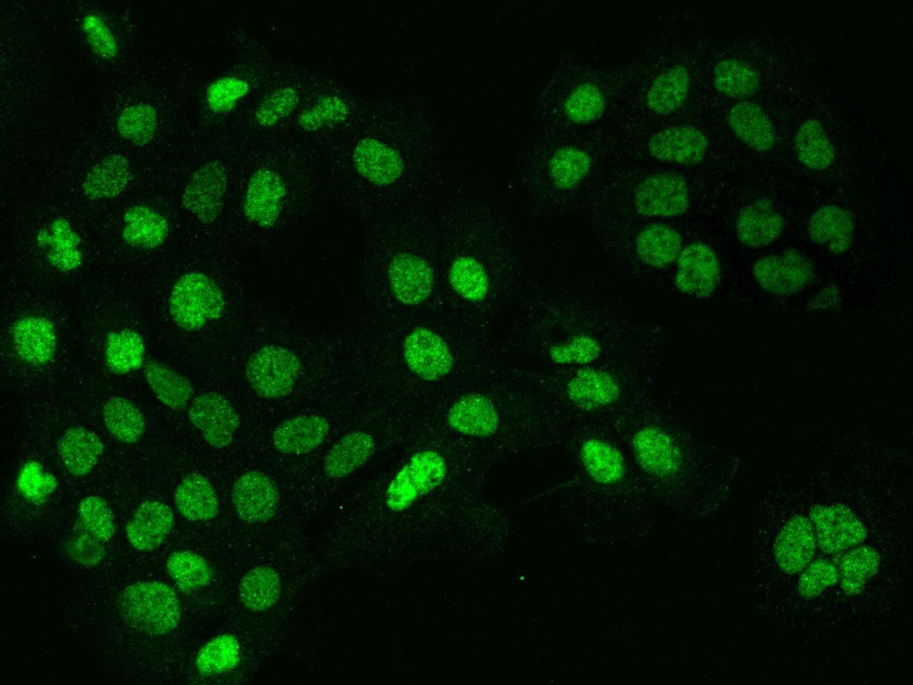 CCNT1 / Cyclin T1 Antibody