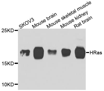 IHC-plus™ HRAS / H-Ras Antibody