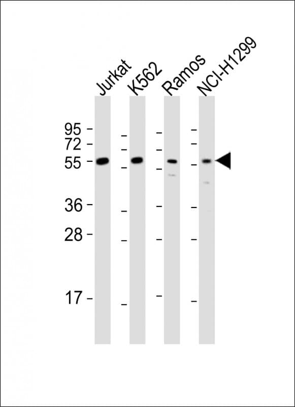 Polyclonal Rabbit anti-Human FOXO4 / AFX1 Antibody (aa206-240, IF, WB)
