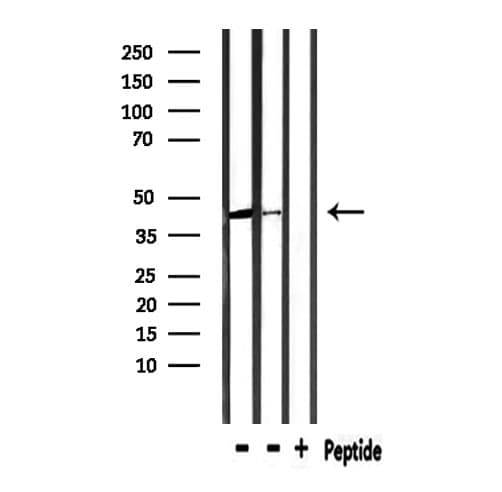 CCR3 Antibody