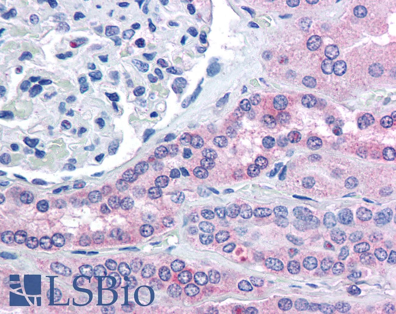 IHC-plus™ RHPN2 Antibody (aa645-655)