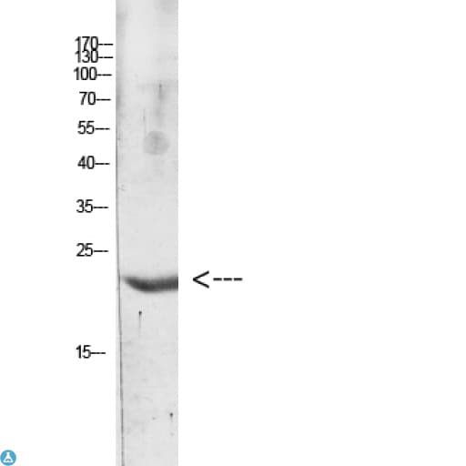 Polyclonal Rabbit anti-Human IL31 Antibody (WB)
